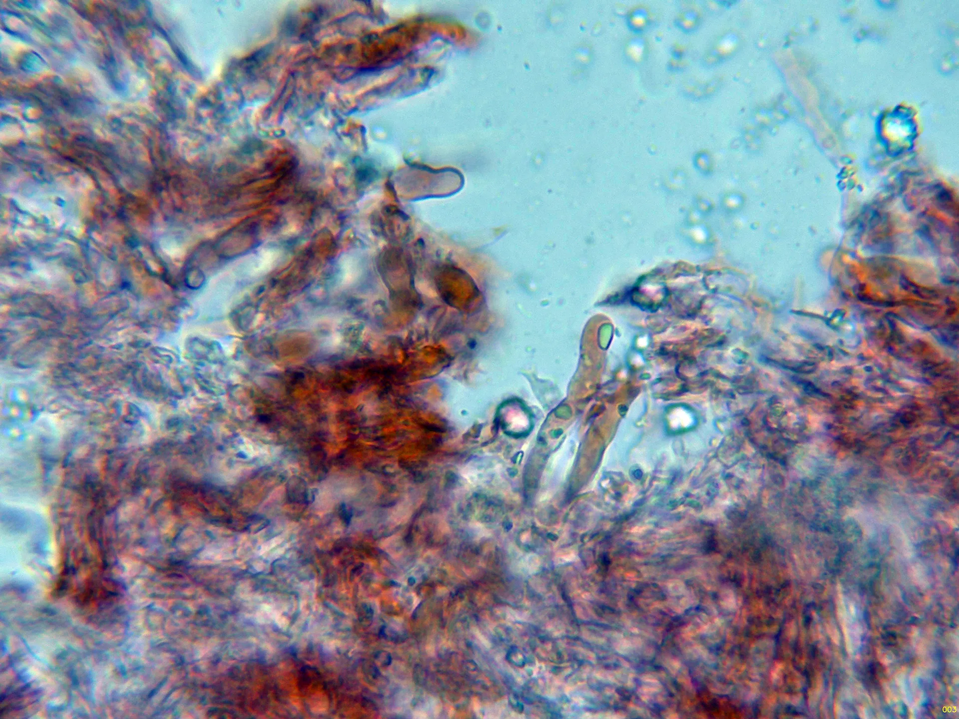 Microscopía de Lyomyces crustosus - 10 - Basidios-003